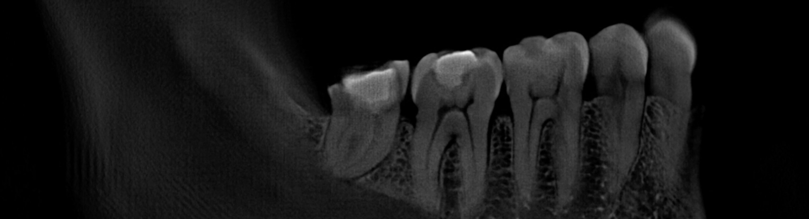 Adaptix-Dentistry-image2